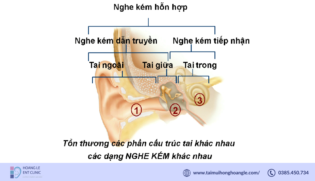 nghe-kem