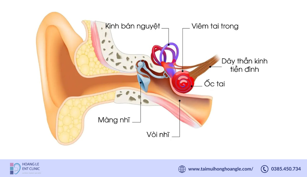 tien-dinh