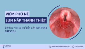 viem-phu-ne-sun-nap-thanh-thiet