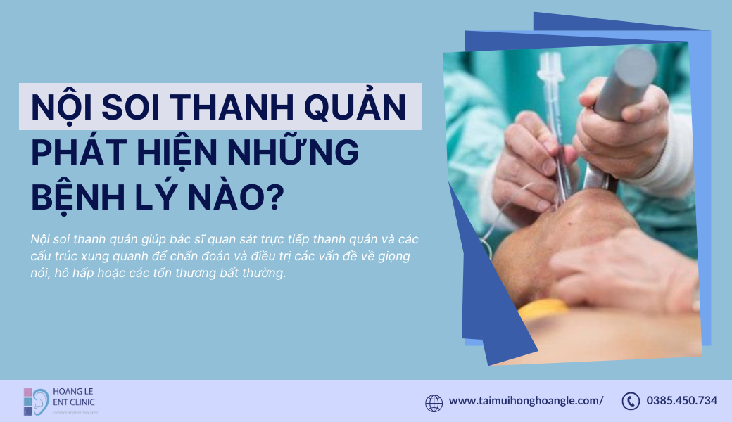 noi-soi-thanh-quan