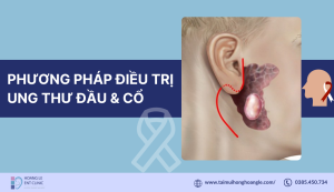 dieu-tri-khoi-u-dau-va-co (1)