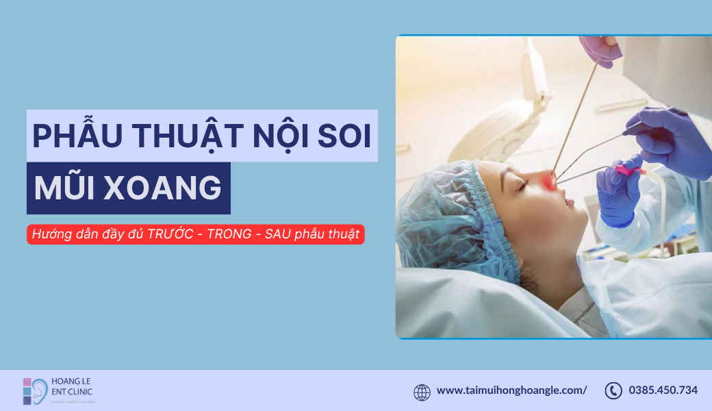 phau-thuat-noi-soi-xoang (2)