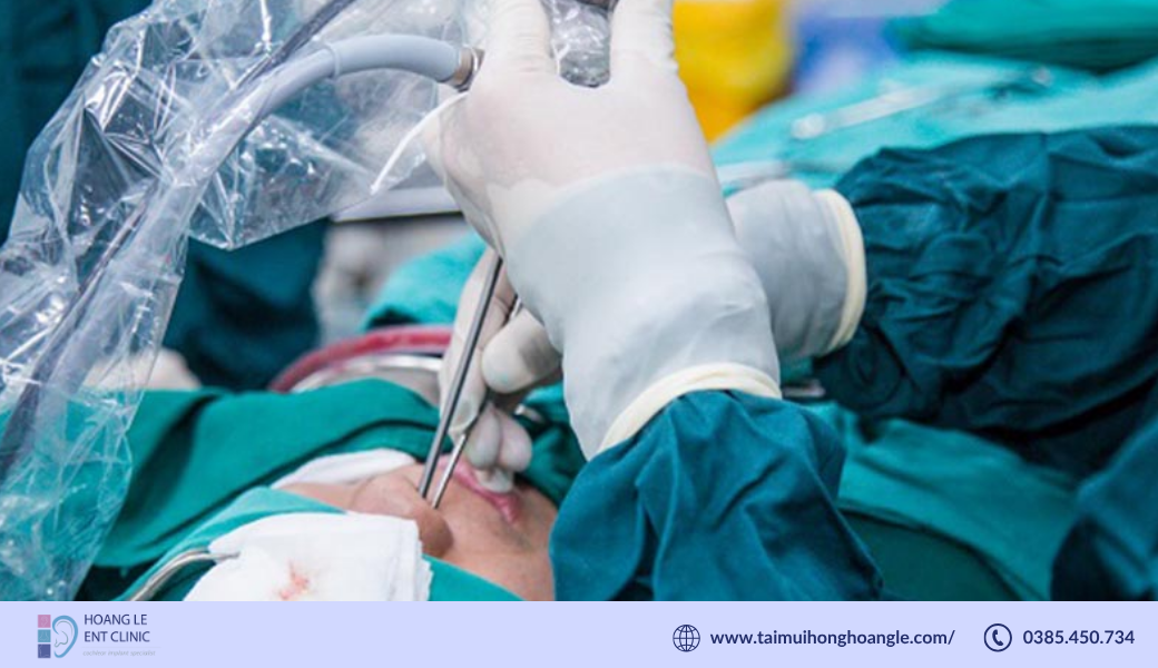 phau-thuat-noi-soi-xoang