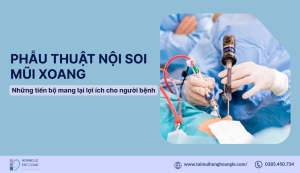 phau-thuat-noi-soi-xoang