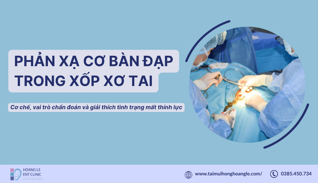 xop-xo-tai (2)